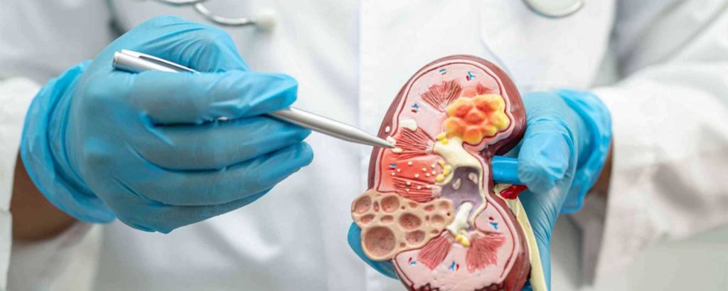 Nephrology Medical Billing