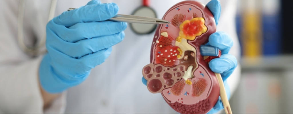 Urology Billing Services New York